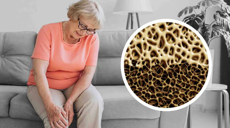 Osteoporose em idosos: causas, diagnóstico e tratamento