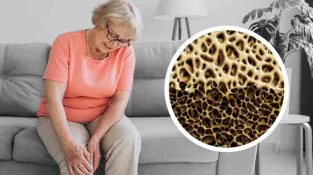 osteoporose-em-idosos Osteoporose em idosos: causas, diagnóstico e tratamento